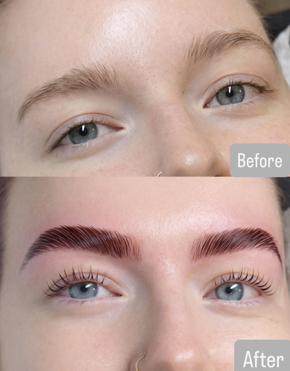 Before & After