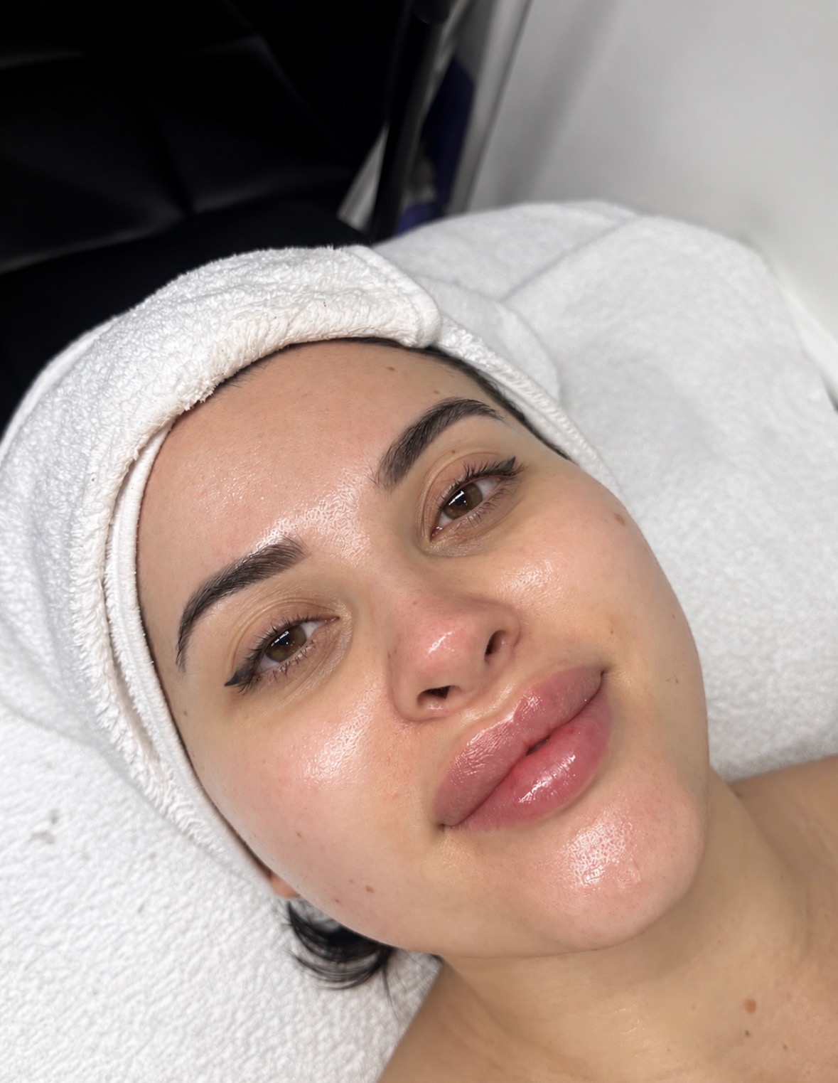 Facial
