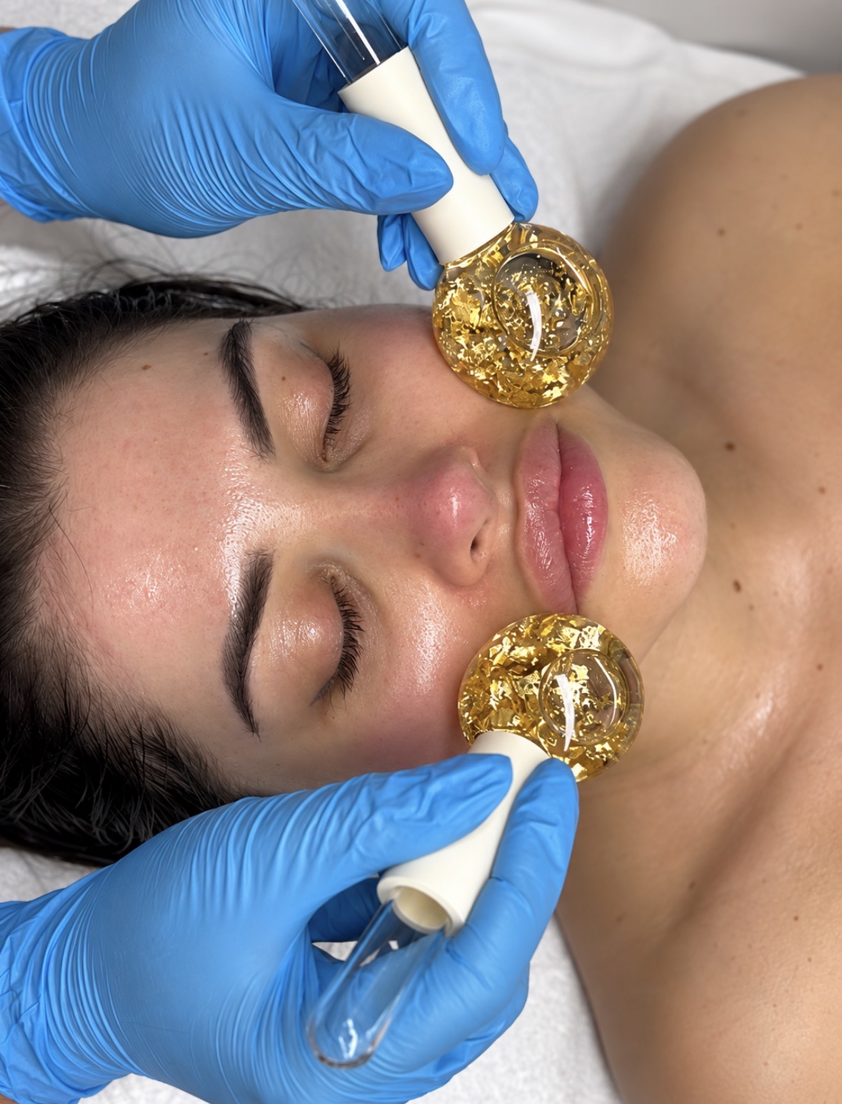 Microdermabrasionbrasion + Deep Cleanse + LED