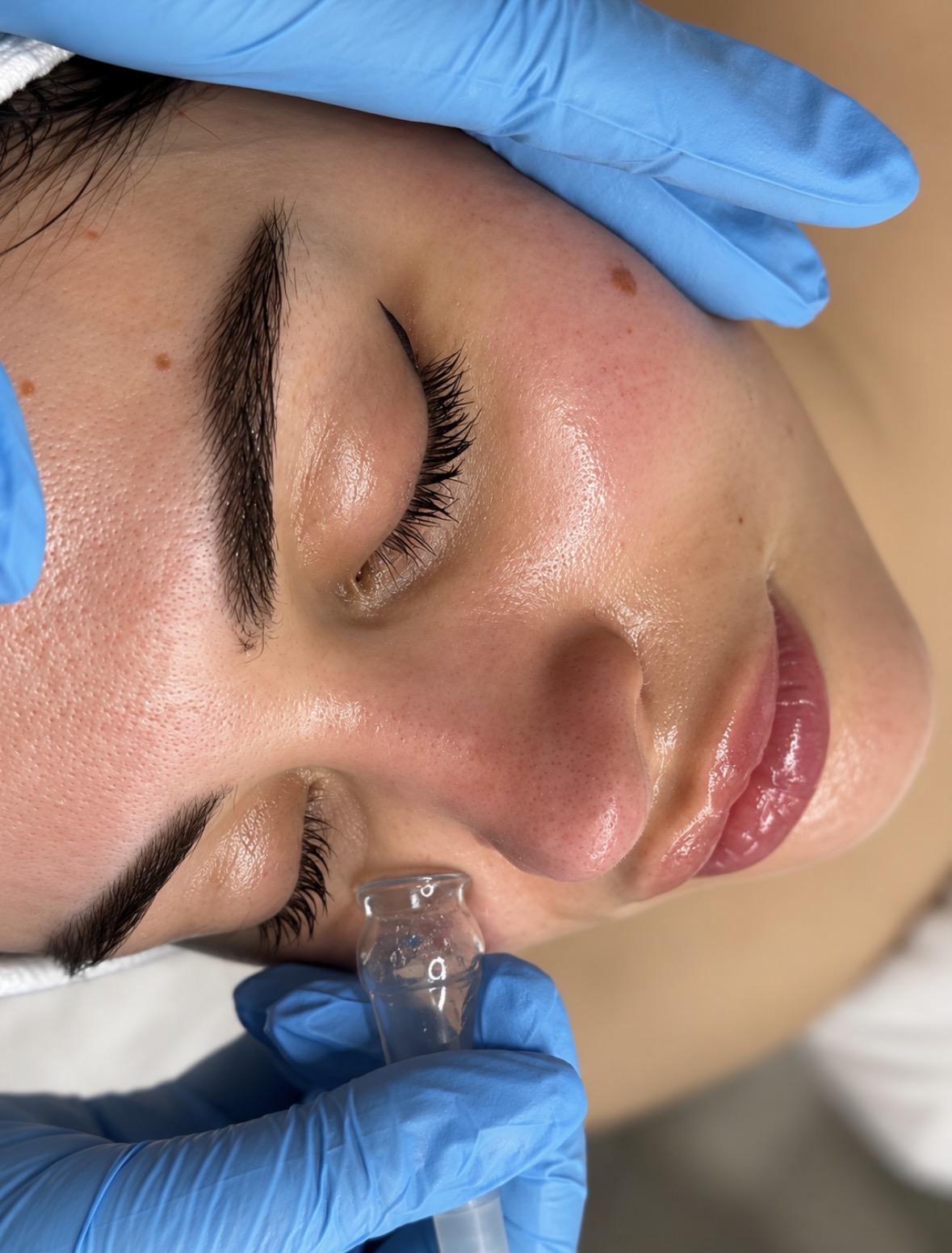 Facials